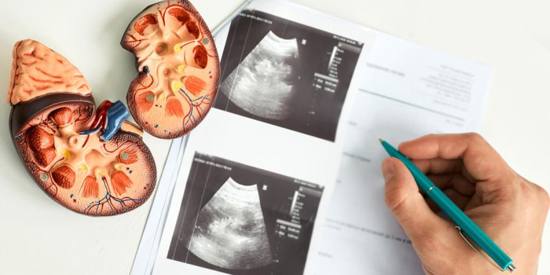 Kidney-ultrasound-scaled.jpg