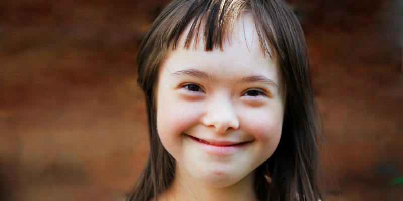 Smiling-Girl-Downs-Syndrome.jpg