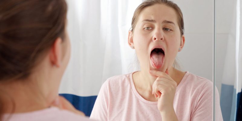 Woman-checking-tongue-scaled.jpg